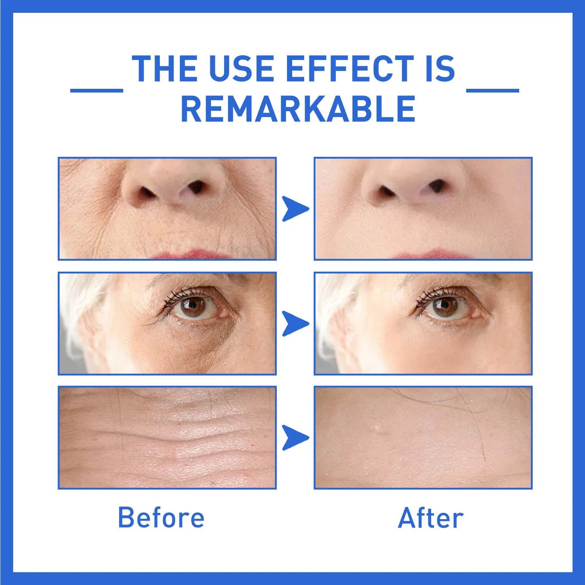✨Sérum Rejuvenecedor Facial Botox 30ml✨